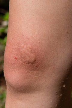 IMG_5511